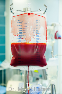 Transfusão de sangue em cirurgia do quadril 