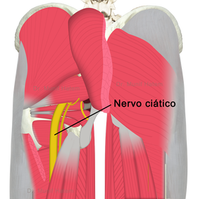 Dor na região glútea e bunda, dor para sentar, músculo glúteo máximo, músculo piriforme e nervo ciático