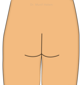 Anatomia da região glútea vista posterior, pele