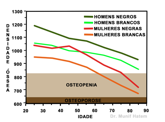 densitometria óssea, exame de densidade óssea em osteoporose e osteopenia