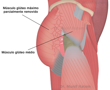 Músculo glúteo médio do quadril, tendinopatia e rupturas do glúteo médio.